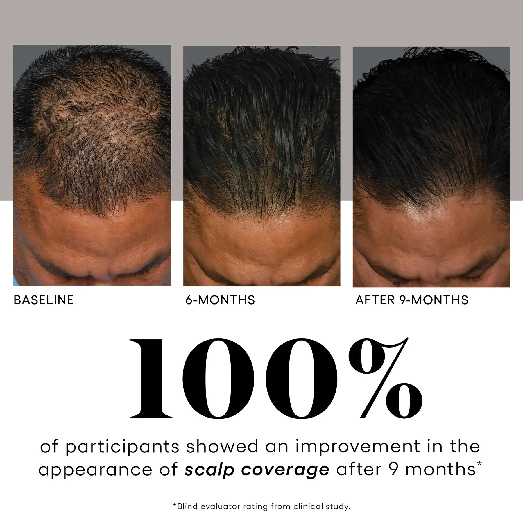 plated hair serum - Image 9