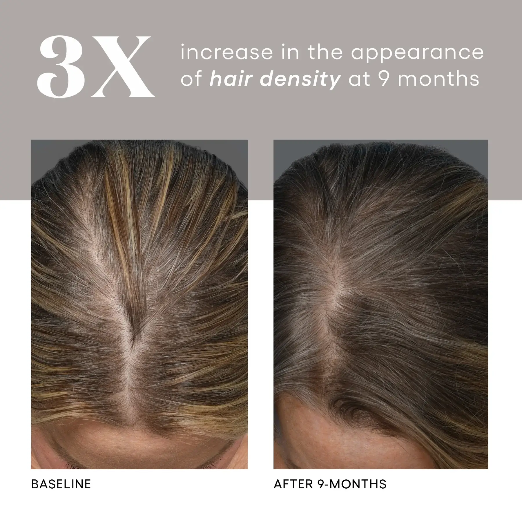 plated hair serum - Image 8